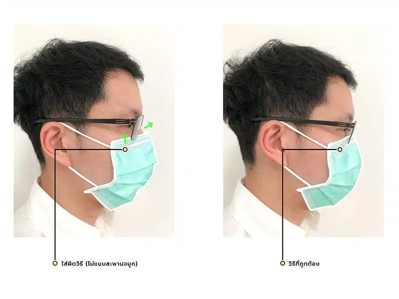 อาการตาแห้ง 2