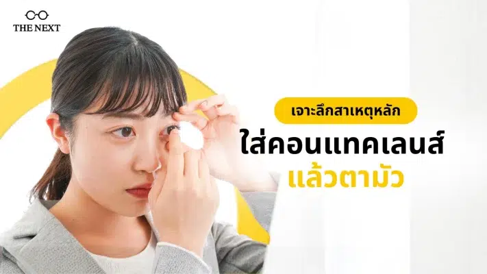 ใส่คอนแทคเลนส์แล้วตามัว
